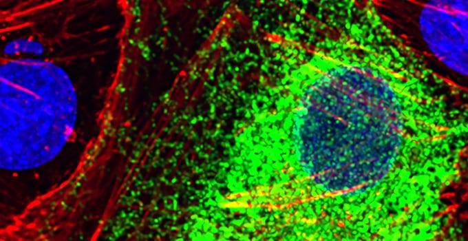 Una inteligencia artificial de Stanford lee la actividad de los genes para distinguir células sanas de enfermas