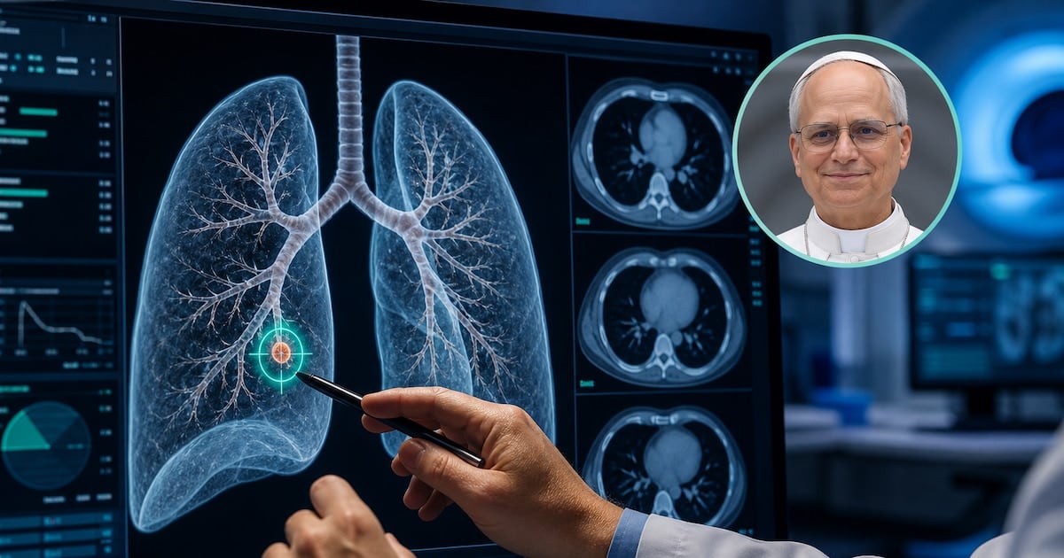 Cuando el hallazgo mide apenas tres milímetros: por qué la medicina actual decide operar un nódulo pulmonar que antes sólo se vigilaba