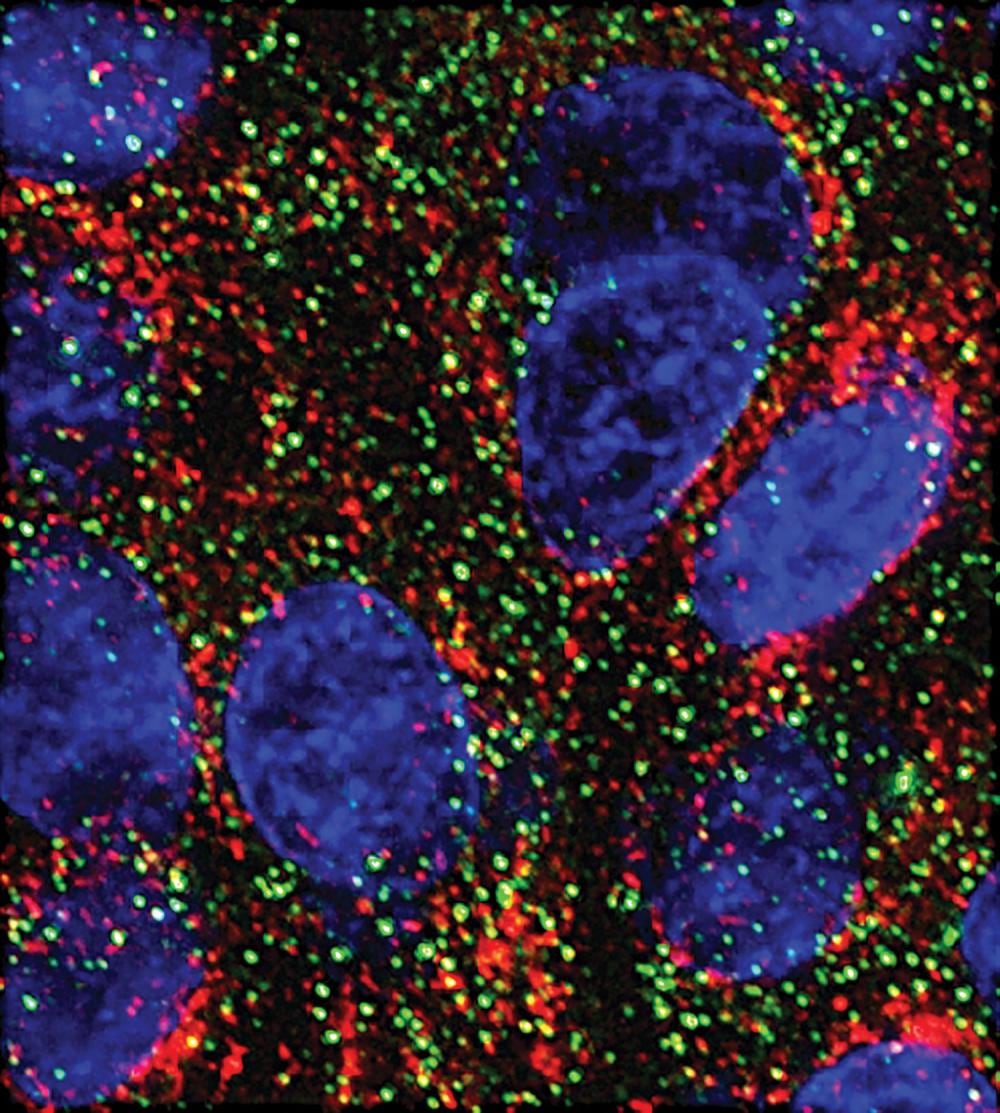 MicroARN muestran una nueva vía para frenar el cáncer de páncreas